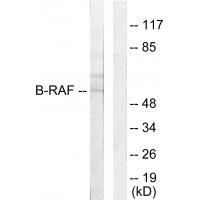 B-RAF Antibody