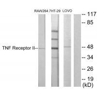 TNF Receptor II Antibody