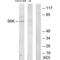 S6K Antibody