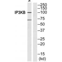 ITPKB Antibody