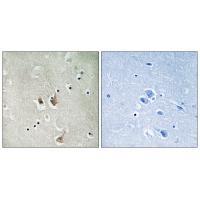 CKS2 Antibody