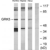 GRK5 Antibody
