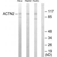 Actin α-2/3 Antibody