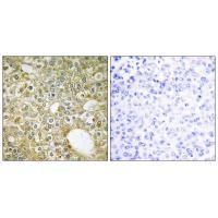 ACVL1 Antibody