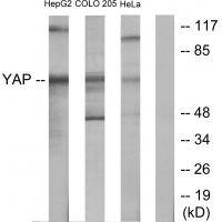 YAP Antibody