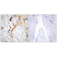 CKI-ε Antibody