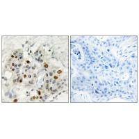 AF4 Antibody