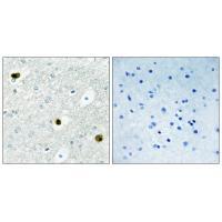 TPD52 Antibody