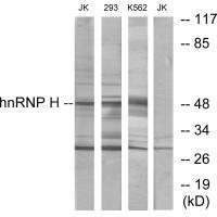 hnRNP H Antibody