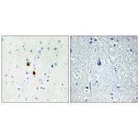 IPKA Antibody