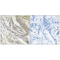 CRBP III Antibody