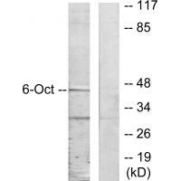 OCT6 Antibody