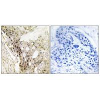 MED21 Antibody