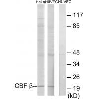 CBF β Antibody