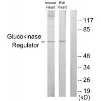 Glucokinase Regulator Antibody
