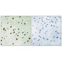 MAD4 Antibody