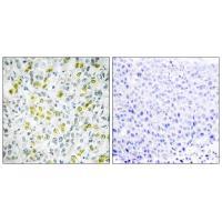 CHD4 Antibody
