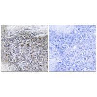 ZMY11 Antibody