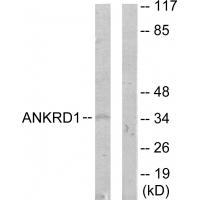 ANKRD1 Antibody