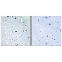 ZFHX3 Antibody