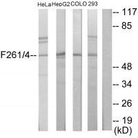 PFKFB1/4 Antibody