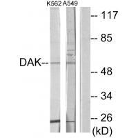 DAK Antibody