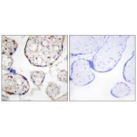 STEAP4 Antibody [#C11207]