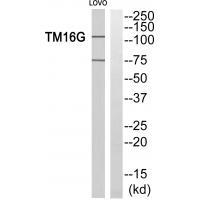 TM16G Antibody