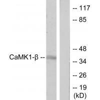 CaMK1-β Antibody