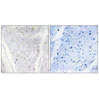 ALPK2 Antibody