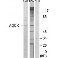 ADCK1 Antibody