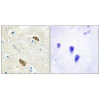 PLXDC1 Antibody