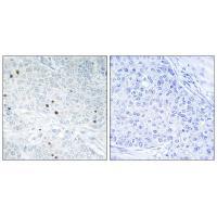 TP53INP2 Antibody