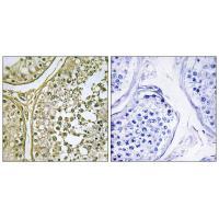 CKI-α1/L Antibody