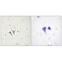 ACTRC Antibody