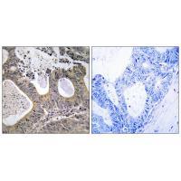 STEA2 Antibody