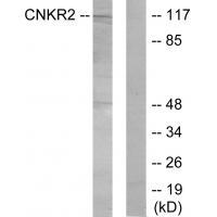 CNKR2 Antibody