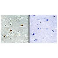 TIP60 Antibody