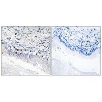 MED12 Antibody