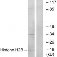 Histone H2B Antibody