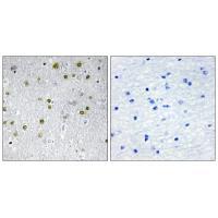 NRIP2 Antibody