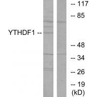YTHDF1 Antibody