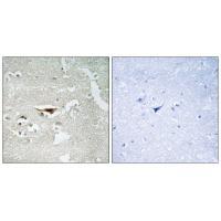 IPKB Antibody