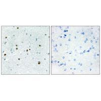 DCLK3 Antibody