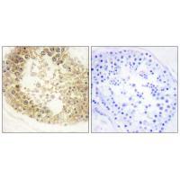 ECRG4 Antibody