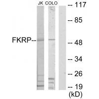FKRP Antibody