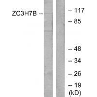 ZC3H7B Antibody