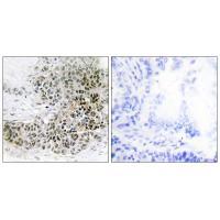 TRPS1 Antibody