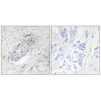 ZNF232 Antibody