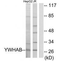 14-3-3 β Antibody